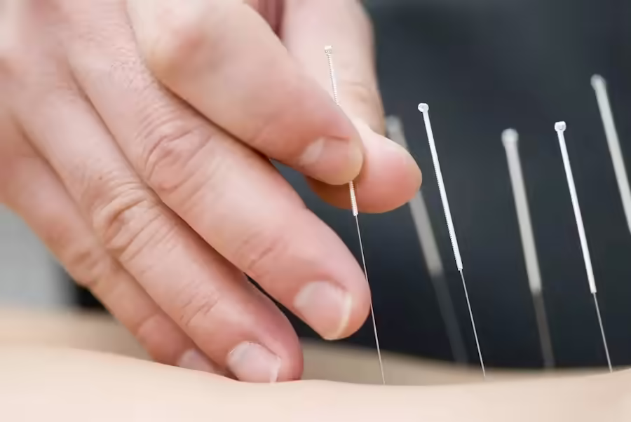 DRY NEEDLING TREATMENTS